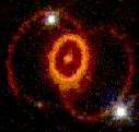 Supernova 1987A rings