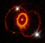 Supernova 1987A rings